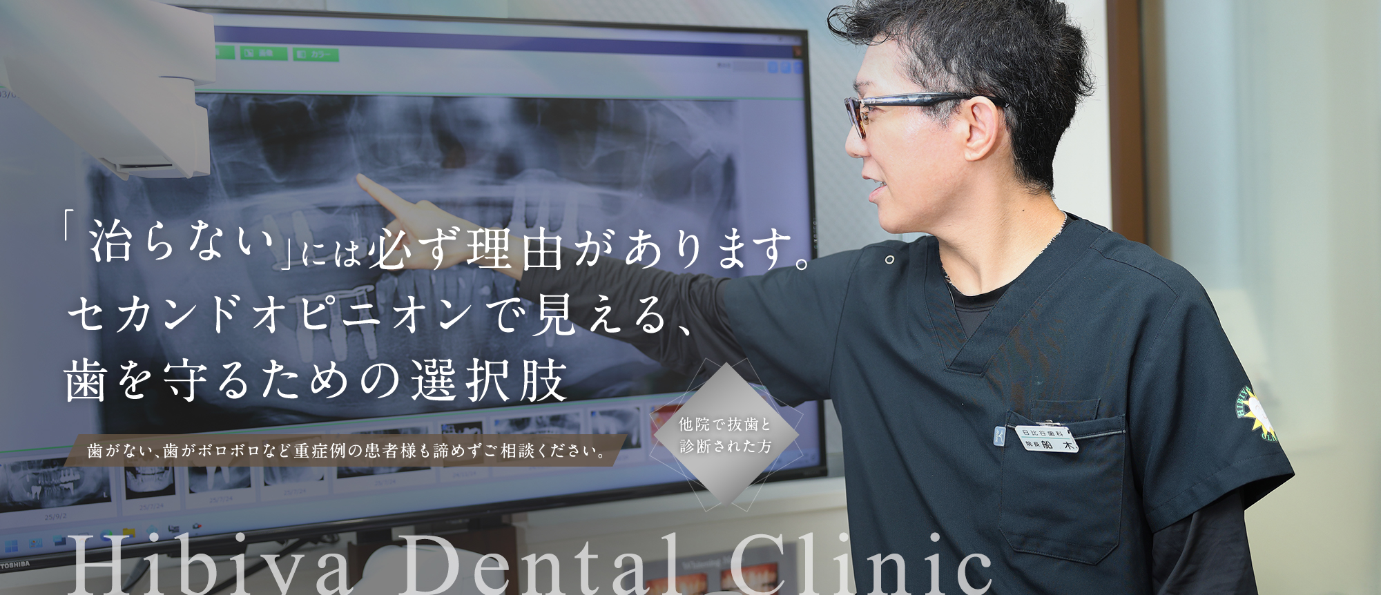 他院で抜歯と診断された方 「治らない」には必ず理由があります。セカンドオピニオンで見える、歯を守るための選択肢 歯がない、歯がボロボロなど重症例の患者様も諦めずご相談ください。