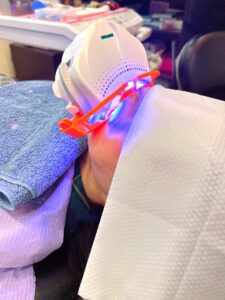 ホワイトニング変わります