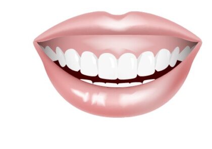 ガミースマイル