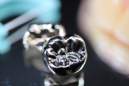 銀歯がむし歯になりやすい理由