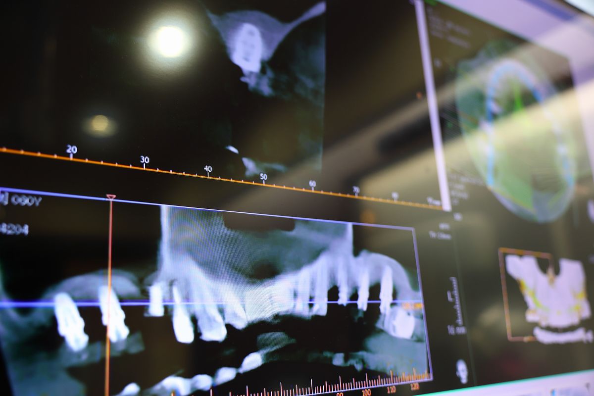 ② デジタル機器を活用した精密診断